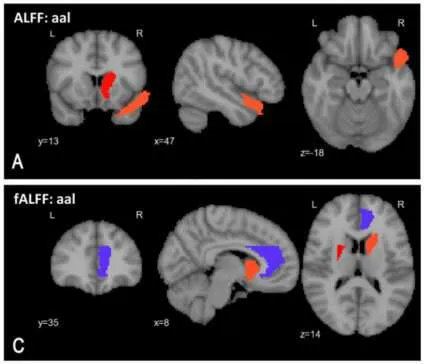 ai for diagnosis